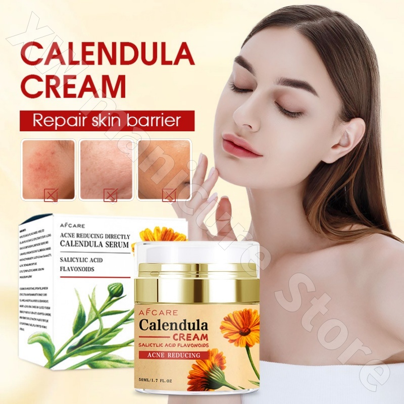 Crema reparadora de caléndula, - Luxury Skincare Whitening Cream reseña y precio