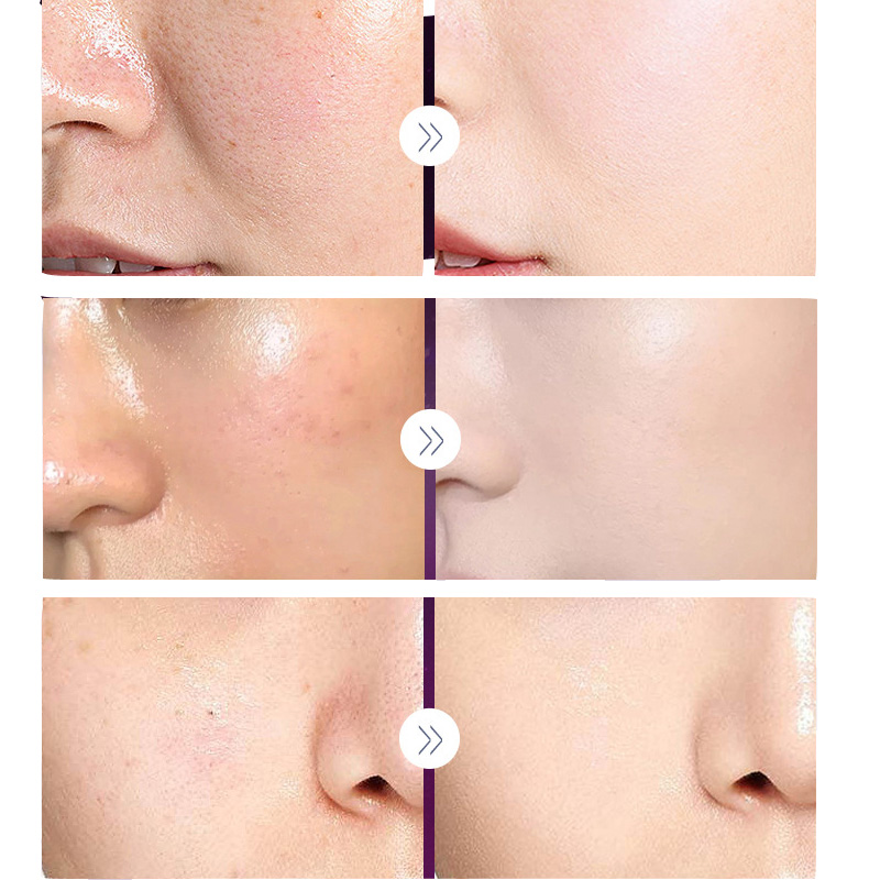 Crema Noble de lujo para mujer - Luxury Skincare Whitening Cream reseña y precio
